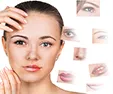 PMU - MB Pigmentation Remover PMU - MB Pigmentation Remover
